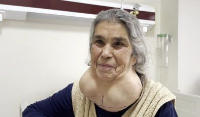 Denizli’de doktor korkusu yüzünden yıllarca devasa kitleyle yaşadı