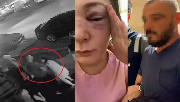 Bursa’da dehşeti yaşattı: Eski sevgilisi vücudunda sigara söndürdü